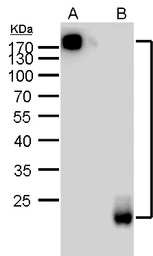 Mouse Anti-Rat IgG (Light chain) antibody [GT569] (HRP). GTX628461-01